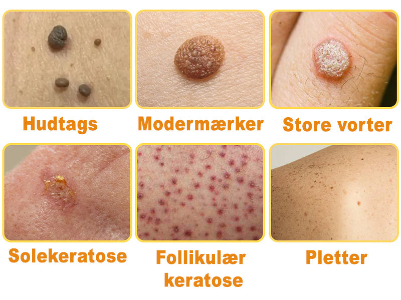 HonningMagien™ Bikemadsmiddel Behandling Creme - Farvel til hudimperfektioner – Hej til glattere, klarere hud!