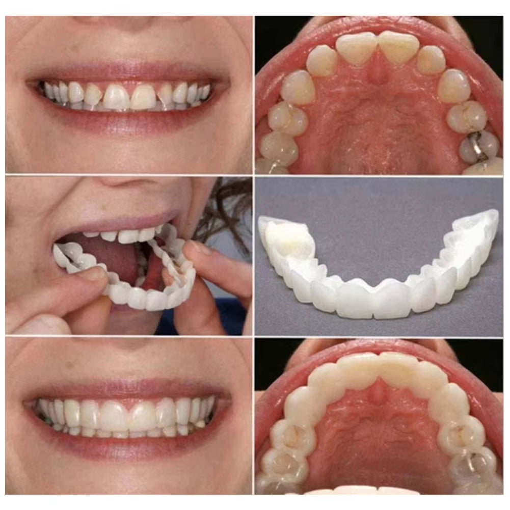 PerfektSmil™ | Fejlfrit smil på få minutter