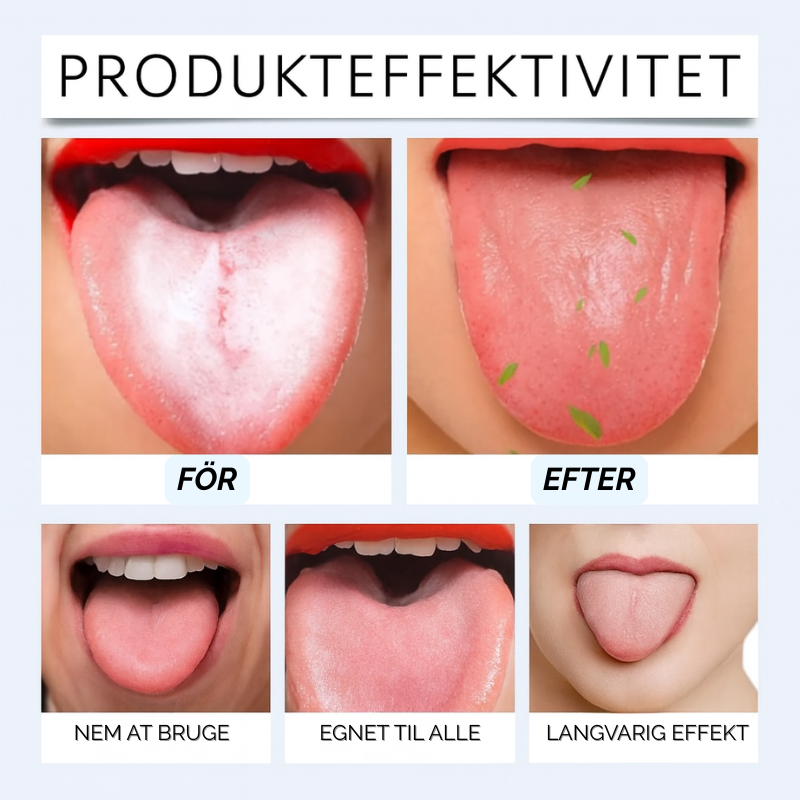 OralMint™ | Sig farvel til belægninger på tungen, dårlig ånde og bakterier.