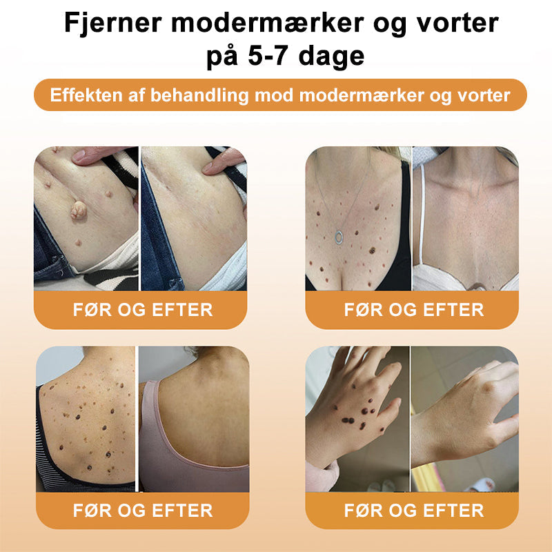 HonningMagien™ Bikemadsmiddel Behandling Creme - Farvel til hudimperfektioner – Hej til glattere, klarere hud!