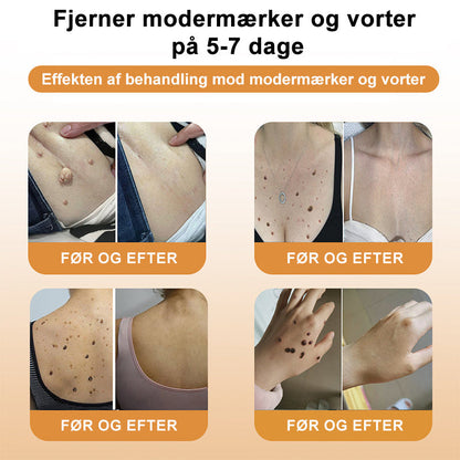 HonningMagien™ Bikemadsmiddel Behandling Creme - Farvel til hudimperfektioner – Hej til glattere, klarere hud!