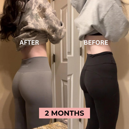 GluteGlow™️ | EMS Sculptor Booty Trainer