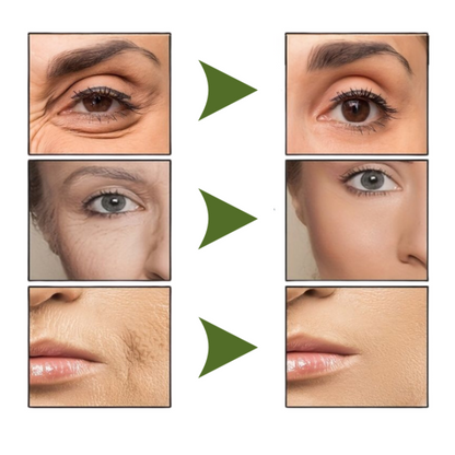 SkinYouth™ | Glattere og rynkefri hud