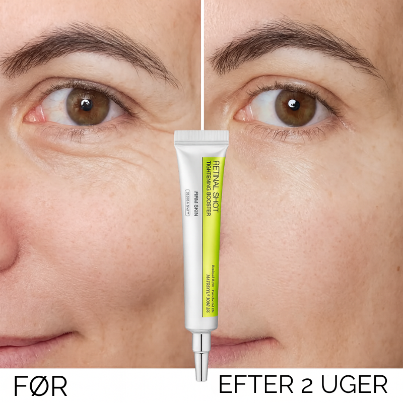 RetiLift™ |Udglat fine linjer – genopliv den sarte hud under øjnene