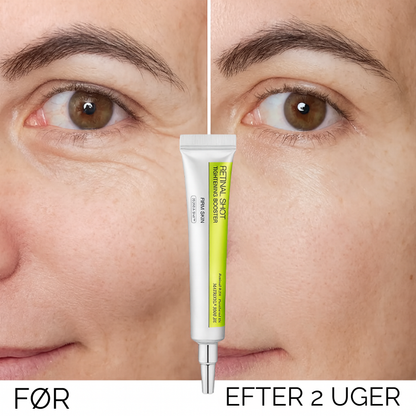 RetiLift™ |Udglat fine linjer – genopliv den sarte hud under øjnene