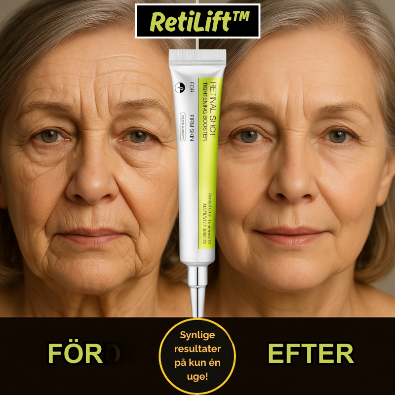 RetiLift™ |Udglat fine linjer – genopliv den sarte hud under øjnene