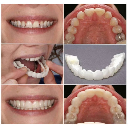 PerfektSmil™ | Fejlfrit smil på få minutter